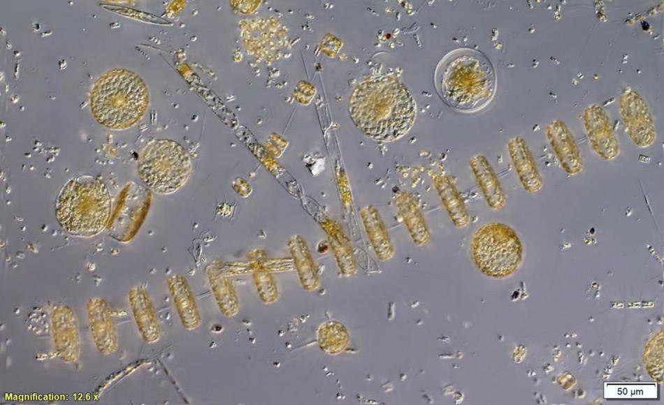 Die Phytoplankton Zellen wurden unter dem Mikroskop vergrÃ¶Ãert. (Bild: Alyce Hancock)