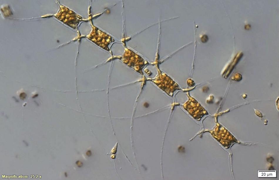 Einzellige marine Pflanzen, Phytoplankton, bilden die Basis des antarktischen Nahrungsnetzes. Sie ermÃ¶glichen die immense Vielfalt des Lebens in der Antarktis einschlieÃlich des Krills, der Robben, Pinguine und Wale. Die Phytoplankton-Zellen wurden unter dem Mikroskop vergrÃ¶Ãert, jede Kette ist ca. 200 Î¼m (Mikrometer) lang, dies entspricht etwa 1/5 Millimeter - oder 1/5 eines Stecknadelkopfes. (Bild: Alyce Hancock)